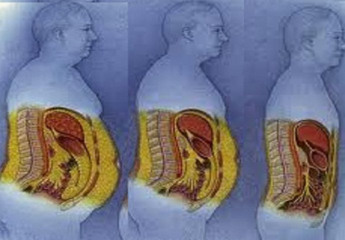 Kako se riješiti sala na trbuhu? - prikaz procesa topljena sala na trbuhu